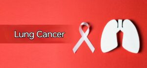 Lung Cancer Diagnostic Dashboard